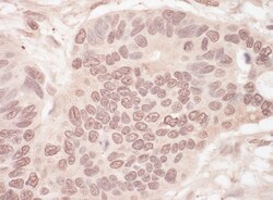 SLTM Antibody, Novus Biologicals 0.1mL; Unlabeled:Antibodies, Polyclonal